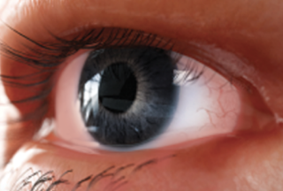 Watery and teary eyes from Thyroid Eye Disease