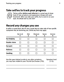 TEPEZZA-treatment-progress-tracker