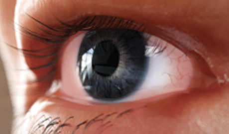 watery-teary-eyes-thyroid-eye-disease